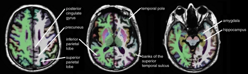 Figure 1a: