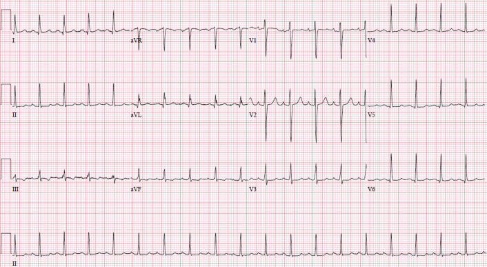 Figure 1