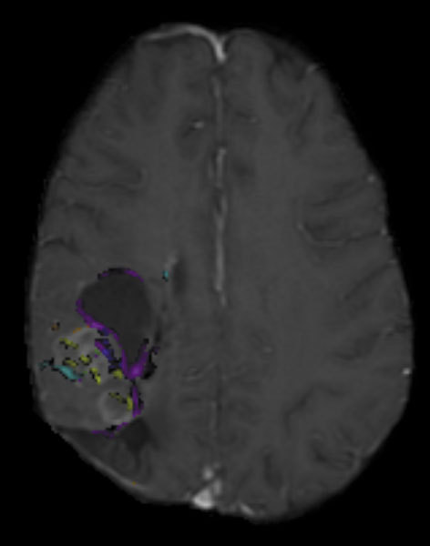 Figure   3