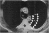 46