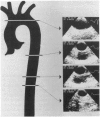 46