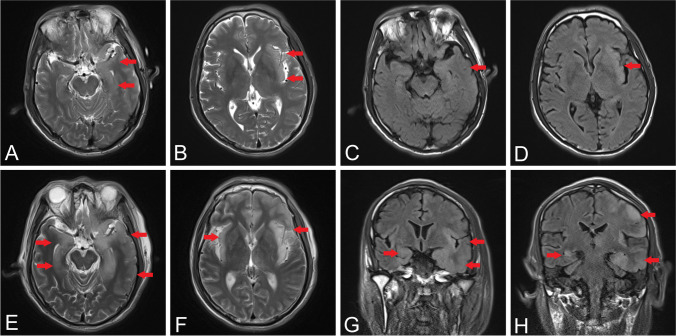 Fig. 5