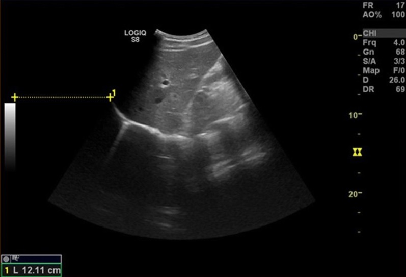 Fig. 2