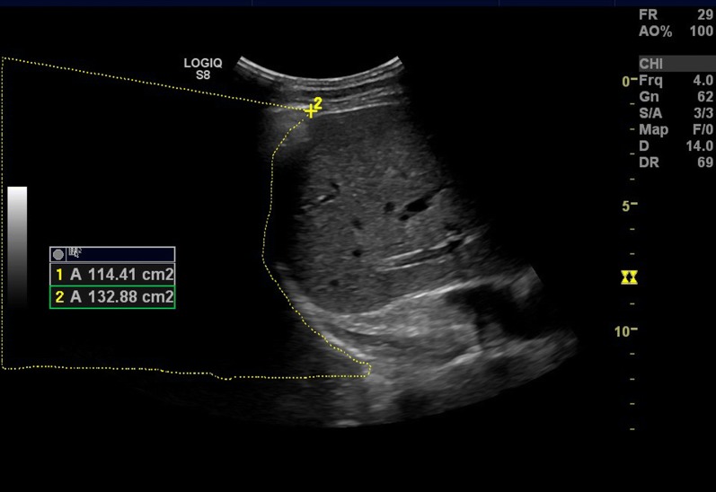 Fig. 4