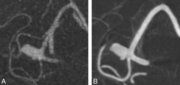 Fig 3.