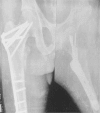 Fig. 16