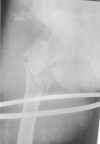 Fig. 11