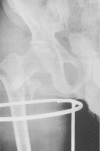 Fig. 15