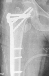 Fig. 12