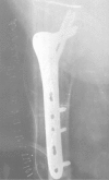 Fig. 13