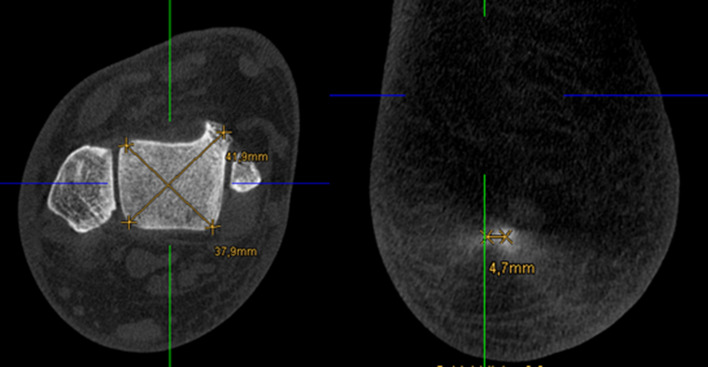 Fig. 3