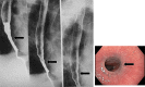 Fig. 23