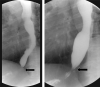 Fig. 26