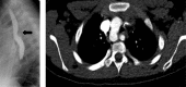 Fig. 22