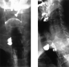 Fig. 17