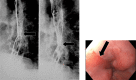 Fig. 24