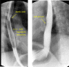 Fig. 14