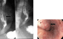 Fig. 11