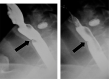 Fig. 28