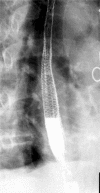 Fig. 12
