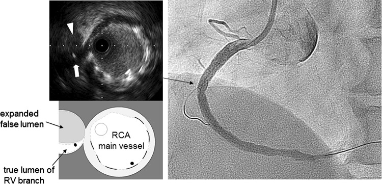 Fig. 2