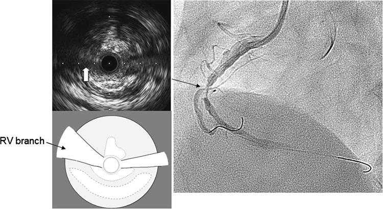 Fig. 1