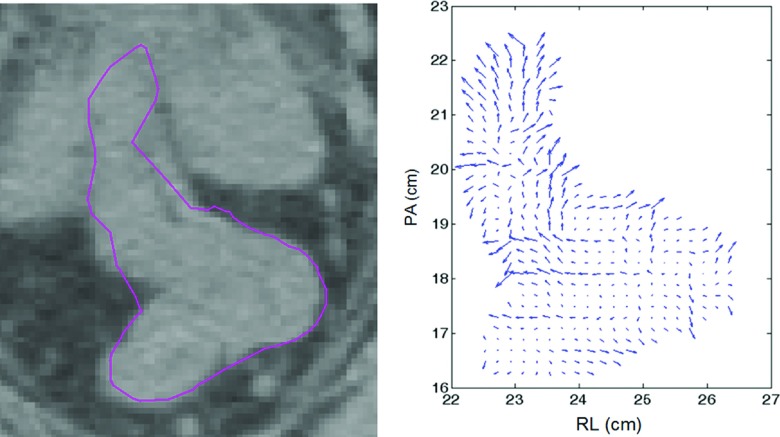 FIG. 1.