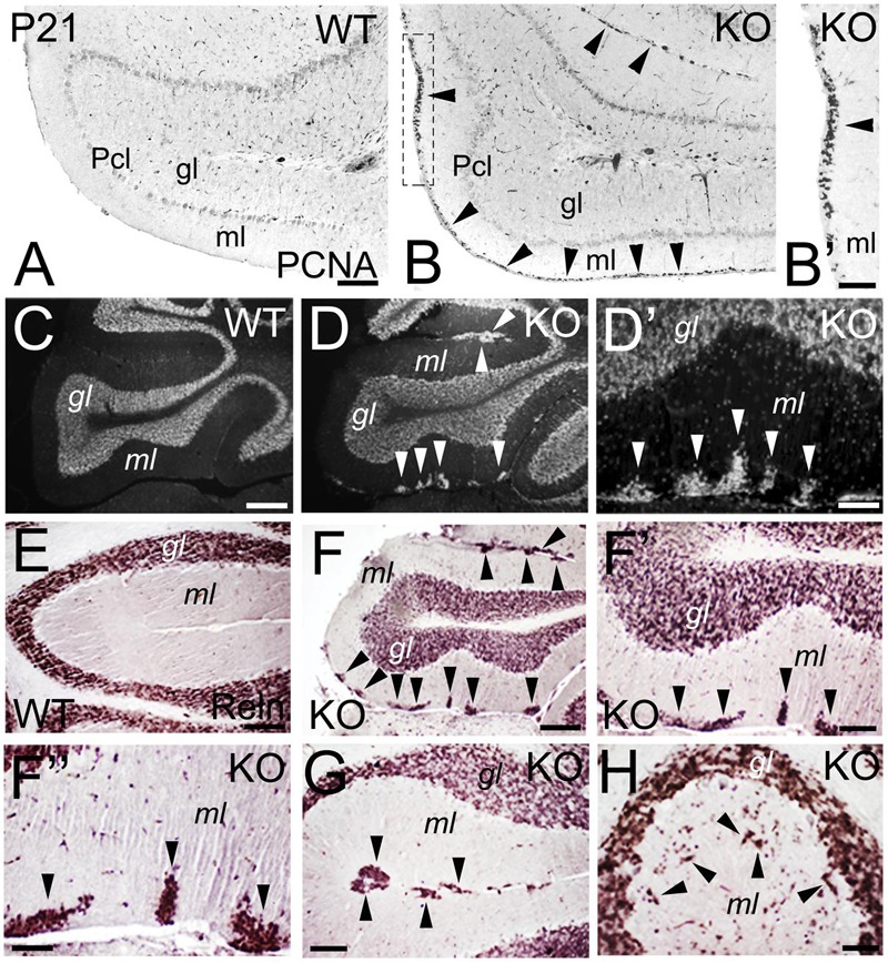 FIGURE 11