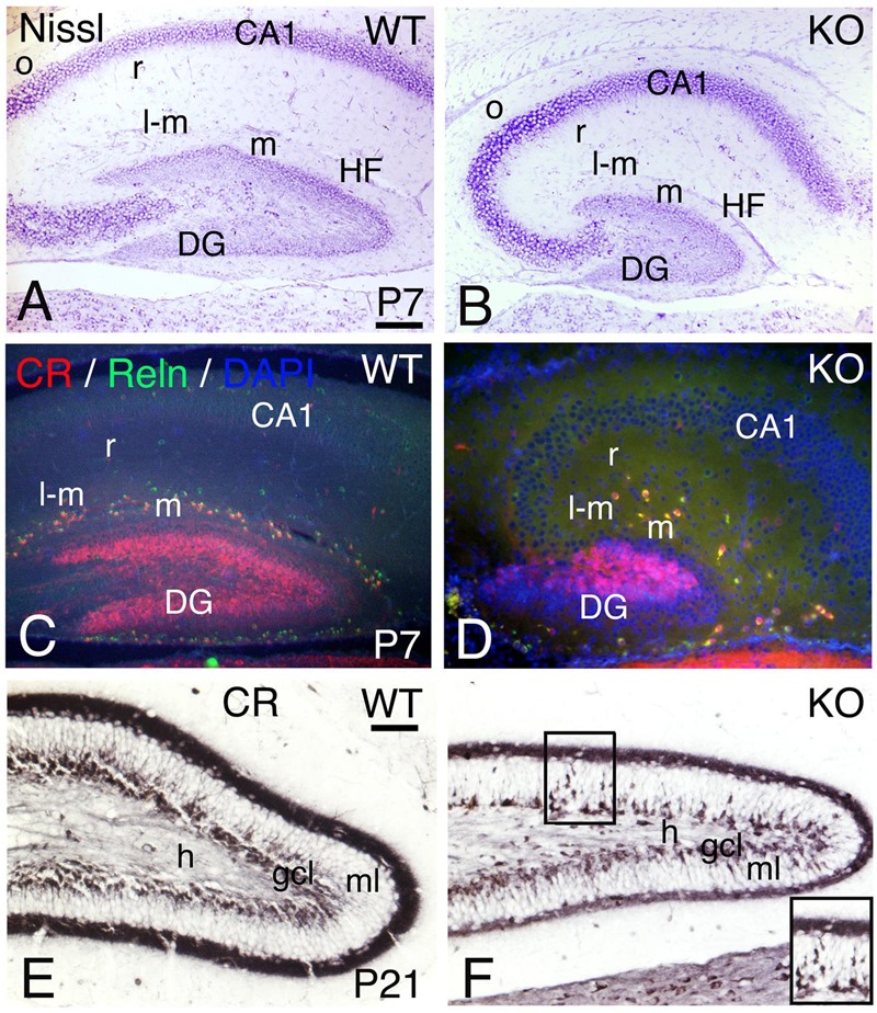 FIGURE 15