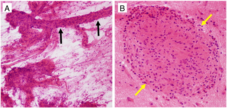 Fig. 4