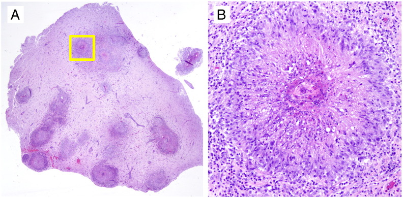 Fig. 5