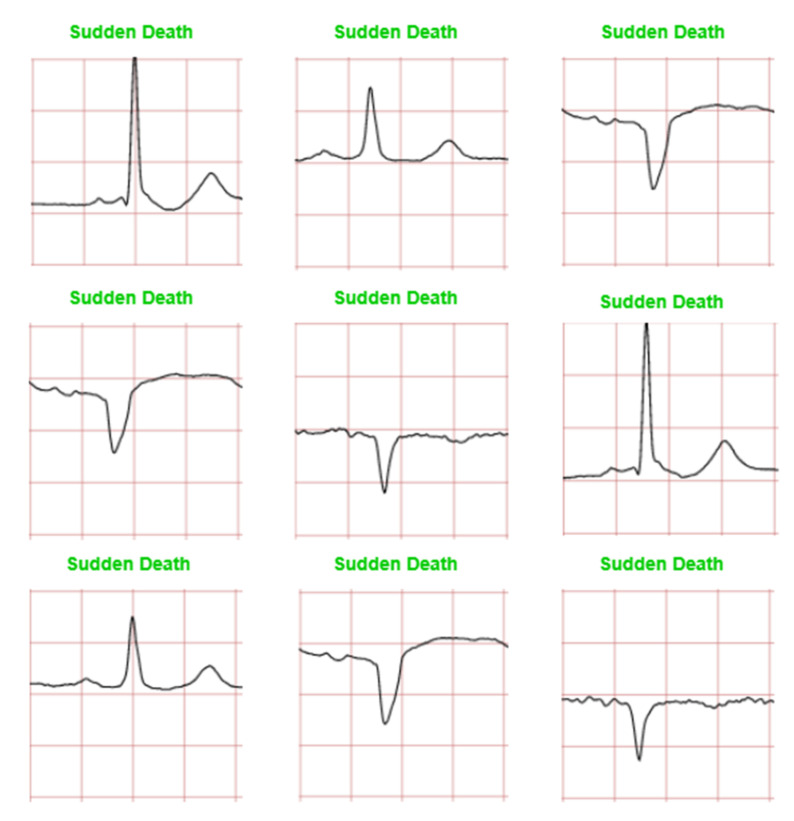 Figure 12