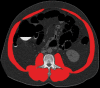 Automated muscle segmentation at abdominal CT. (a) Axial CT image at the L3 level in a 50-year-old man shows the automatically segmented muscle (red shading). (b) Graph of automated CT-based muscle area and attenuation differences according to subject age shows that muscle attenuation (red line) decreases at a greater rate with aging compared with the cross-sectional area (blue line). (c) Graph shows that this trend exists for both men and women. After age 70, both muscle attenuation and area values plateau more in women than in men. (Reprinted, with permission, from reference 19.)