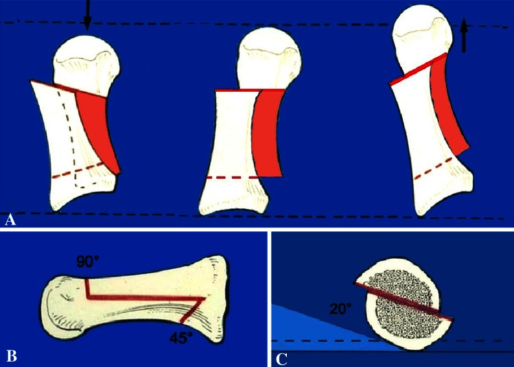 Fig. 5A–C