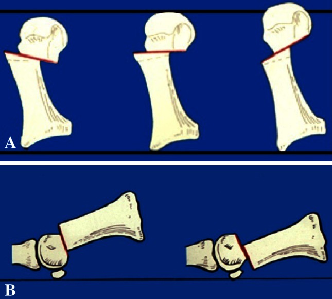 Fig. 4A–B