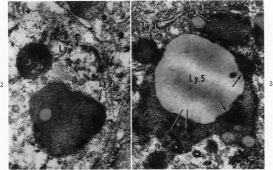 Fig. 2 and 3