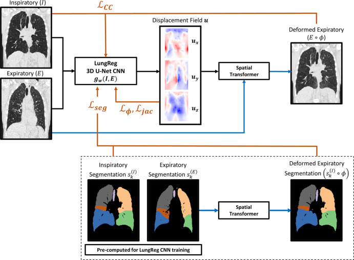 Flow diagram of loss functions incorporated into the training of the lung deformable image registration algorithm (LungReg). Inspiratory (I) and affine-registered expiratory (E) images are propagated through a three-dimensional (3D) U-Net convolutional neural network (CNN), gw(I,E), to predict a displacement field (u). The spatial transformation is then applied to affine-registered expiratory images using a spatial transformer to deformably register expiratory images to inspiratory images. Four loss function components point to the U-Net because they are used to optimize U-Net weights: cross-correlation for image similarity (ℒCC), displacement regularization for smooth deformations (ℒφ), Dice overlap score for alignment of anatomic structures (ℒseg), and percentage of voxels with nonpositive Jacobian determinants (ℒjac) to encourage transformation invertibility. Note the segmentations are only used during LungReg training and are not required during inference time. Black lines = forward propagation, blue lines = spatial transformations, orange lines = loss functions, ϕ = spatial transformation function.