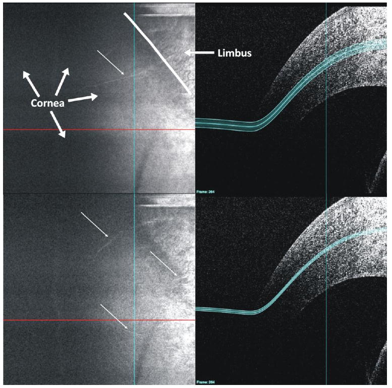 Fig. 12