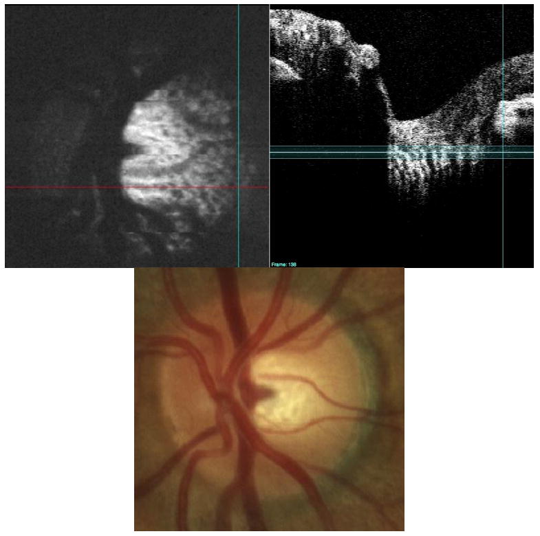 Fig. 11