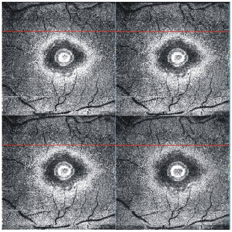 Fig. 8