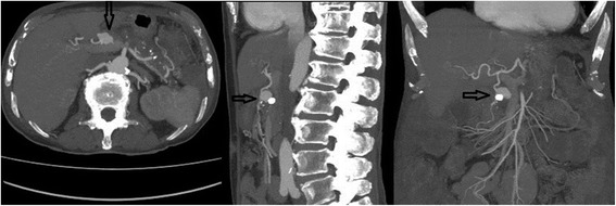 Fig. 5