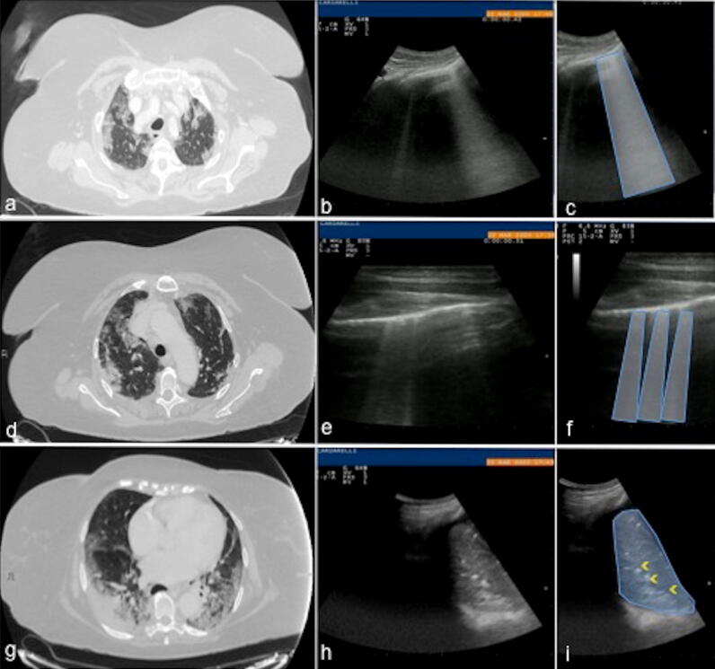 Fig. 15