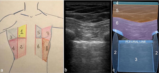 Fig. 1