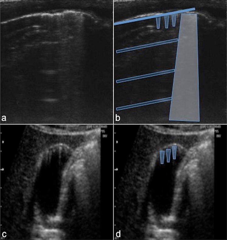 Fig. 14