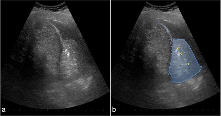 Fig. 5