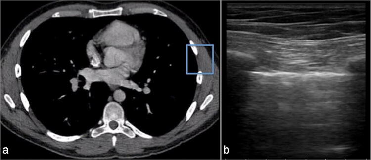 Fig. 6