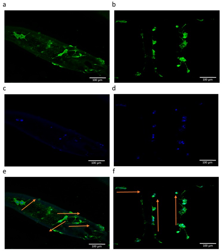 Figure 14