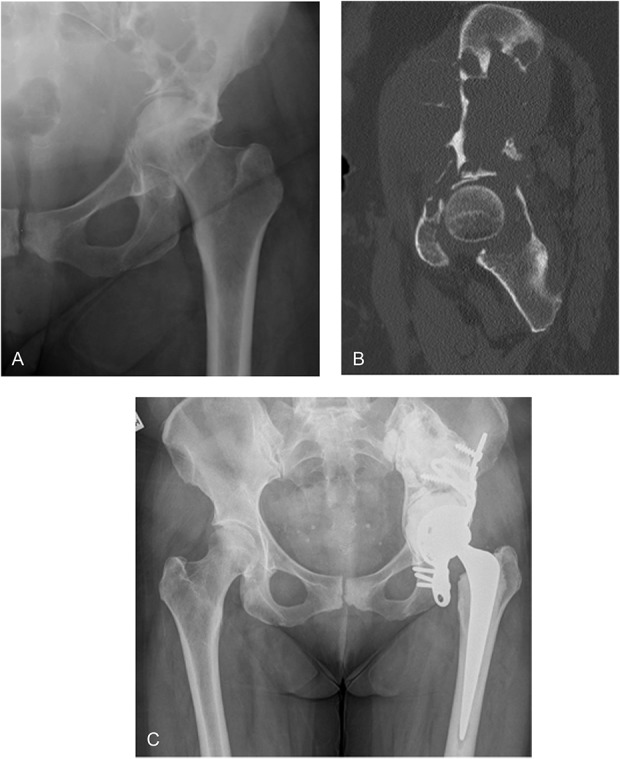 Fig. 3 A-C