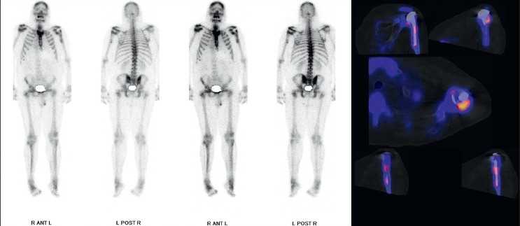 Figure 3b