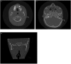 Fig. 7.